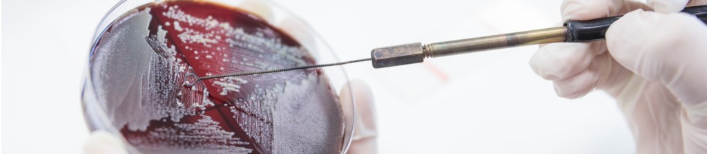 Scientist poking at a red substance in a lab tray