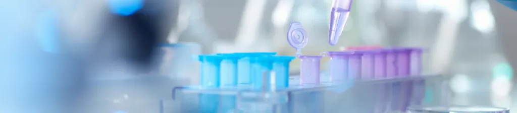 dropper and test tubes in laboratory